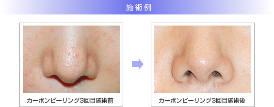 施術例